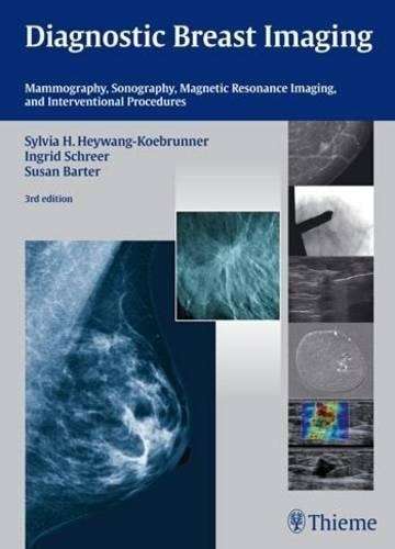 Diagnostic Breast Imaging - Sylvia H. Heywang-Koebrunner