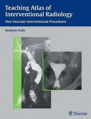 TEACHING ATLAS OF INTERVENTION RADIOLOGY - KADIR,S