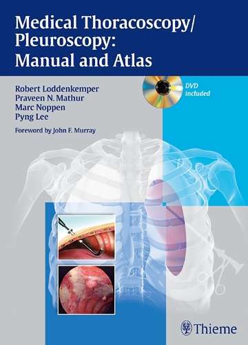 Medical Thoracoscopy / Pleuroscopy: Manual and Atlas - Robert Loddenkemper