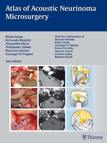 Atlas of Acoustic Neurinoma Microsurgery - Mario Sanna