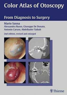 Color Atlas of Otoscopy - M. Sanna