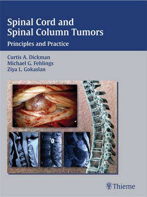 Spinal Cord and Spinal Column Tumors - DICKMAN,C