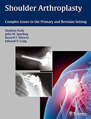 Shoulder Arthroplasty - FEALY,S