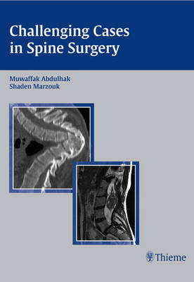 Challenging Cases in Spine Surgery - Muwaffak Abdulhak
