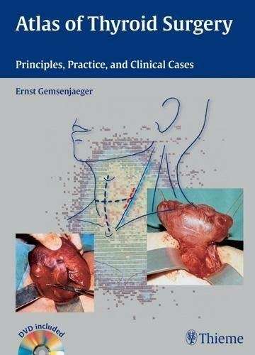 Atlas of Thyroid Surgery - Ernst Gemsenjaeger