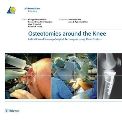 Osteotomies Around the Knee - Philipp Lobenhoffer