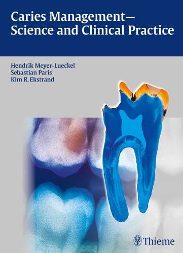 Caries Management - Science and Clinical Practice - LUECKEL,M