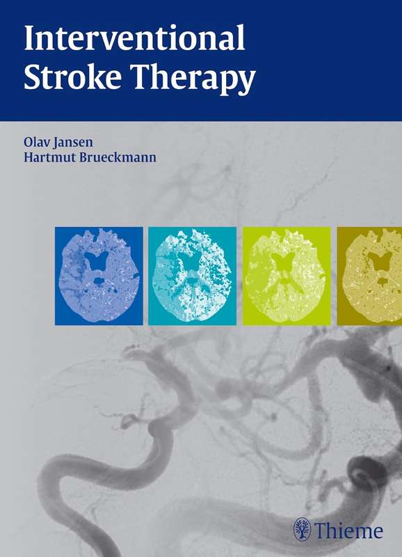 Interventional Stroke Therapy - Olav Jansen