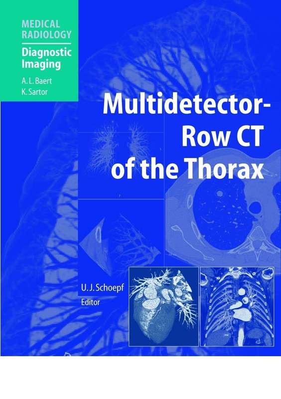 Multidetector-row CT of the Thorax - SCHOEPF,UJ