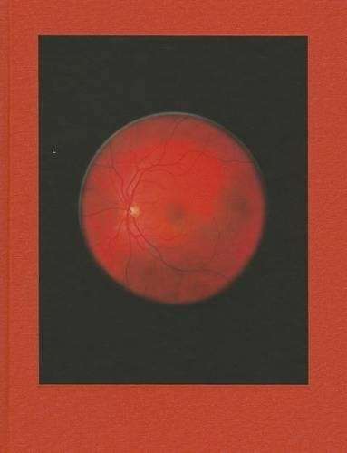 Mikhael Subotzky: Retinal Shift - Mikhael Subotzky