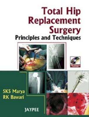 Total Hip Replacement Surgery - S. K. S. Marya