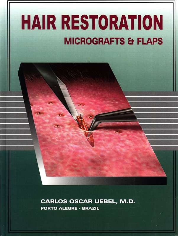 HAIR RESTORATION MICROGRAFTS FLAPS - UEBEL,C