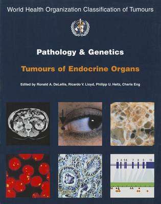 Pathology and genetics of tumours of the endocrine organs - Ronald A. Delellis