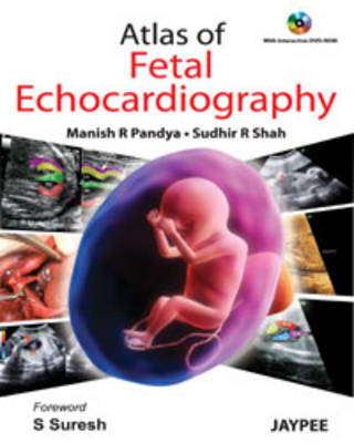 Atlas of Fetal Echocardiography - Manish R. Pandya