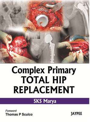Complex Primary Total Hip Replacement - S. K. S. Marya