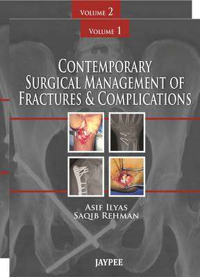 Contemporary Surgical Management of Fractures and Complications - Asif M. Ilyas