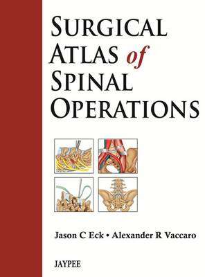 Surgical Atlas of Spinal Operations - Alexander R. Vaccaro