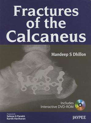 Fractures of the Calcaneus - Mandeep S. Dhillon