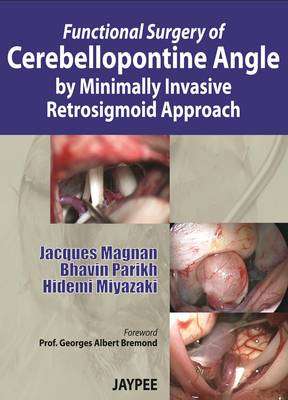 Functional Surgery of Cerebellopontine Angle by Minimally Invasive R - Jacques Magnan
