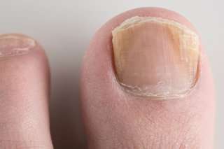 Anti-Fungal Nail Treatment 50ml