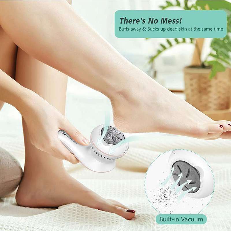 Igia Callus Remover