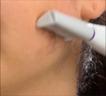 Igia Dermaplaner Hair Remover