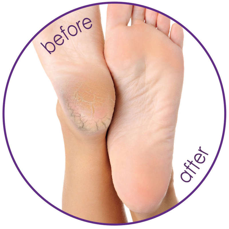 Silky Sox Spa Gel Pedicure Set