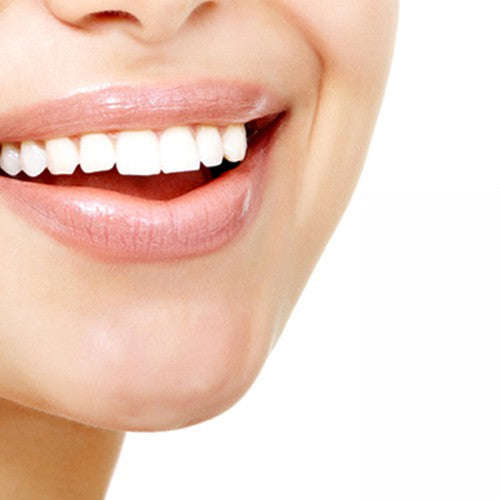 Professional Teeth Whitening Home Kit
