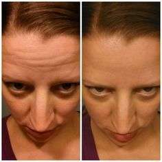 Instantly Ageless - Box of 10 Sachets