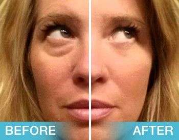 Instantly Ageless - Box of 10 Sachets