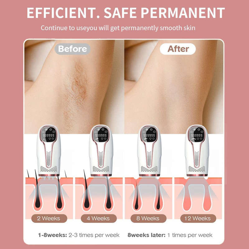 Painless Laser Permanent Hair Removal Epilator 500,000 Flashes