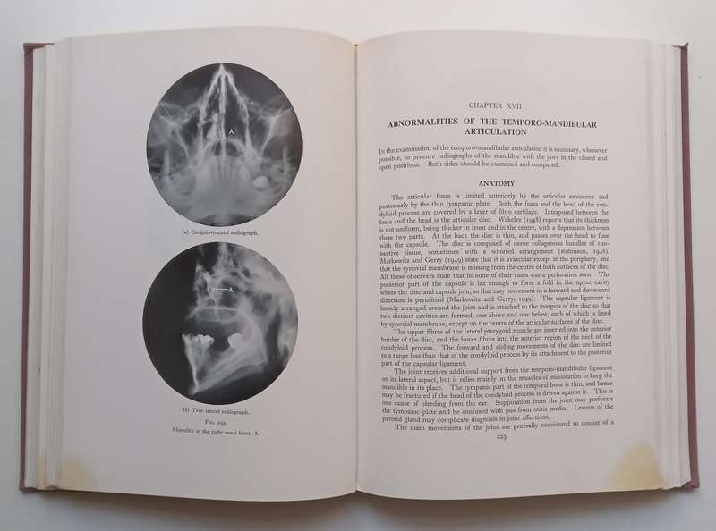Dental and Oral X-Ray Diagnosis (Published 1954) | A. C. W. Hutchinson