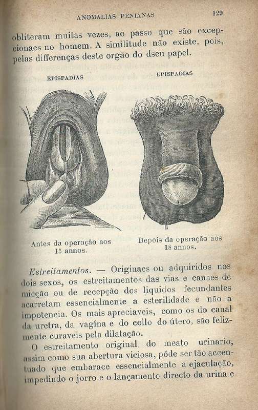 As Anomalias Sexuaes Apparentes e Occultas (Spanish) | Dr. P. Garnier