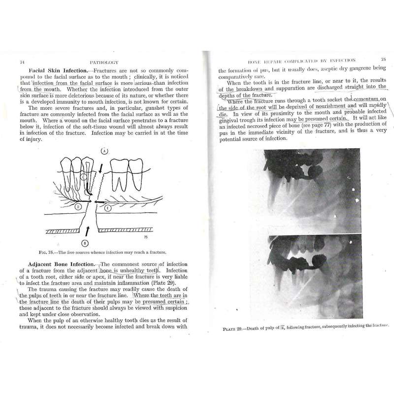 The Dental Treatment of Maxillo-Facial Injuries (Published 1944) | W. Kelsey Fry, et al.