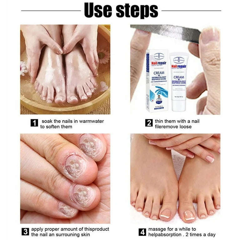 Nail Repair - Against Nail Fungus - 20g