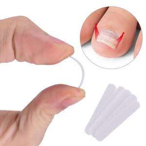 Ingrown Toenail Correction Brace - 12pcs