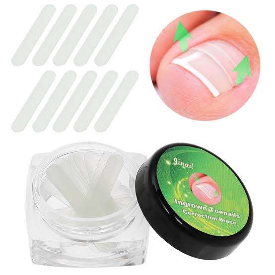 Ingrown Toenail Correction Brace - 12pcs