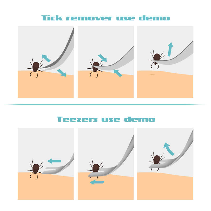 Pets Cats Dogs Grooming Glove Tick Remover Tool Set Kit Stainless Steel Tweezers for Ticks