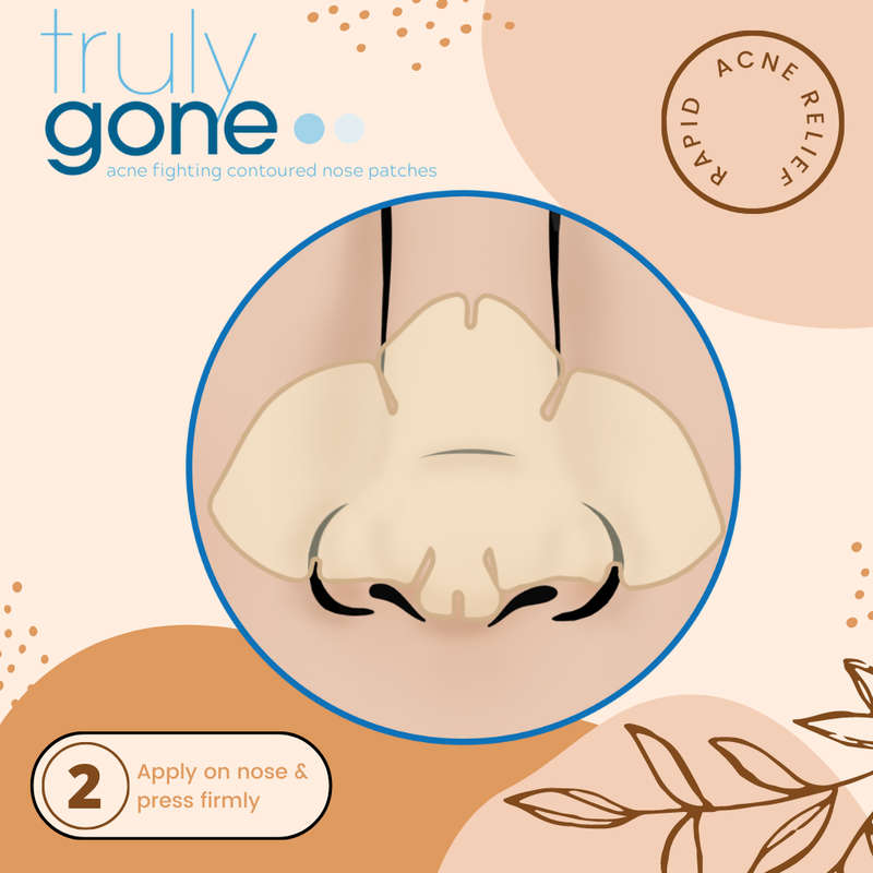 Truly Clear Contoured Nose Patches