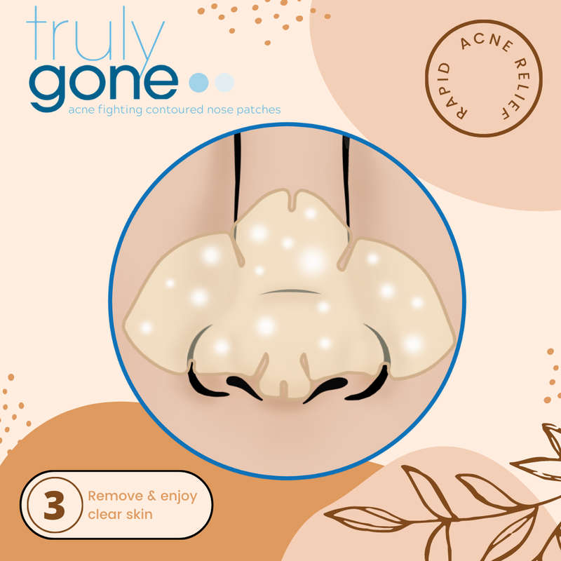 Truly Clear Contoured Nose Patches
