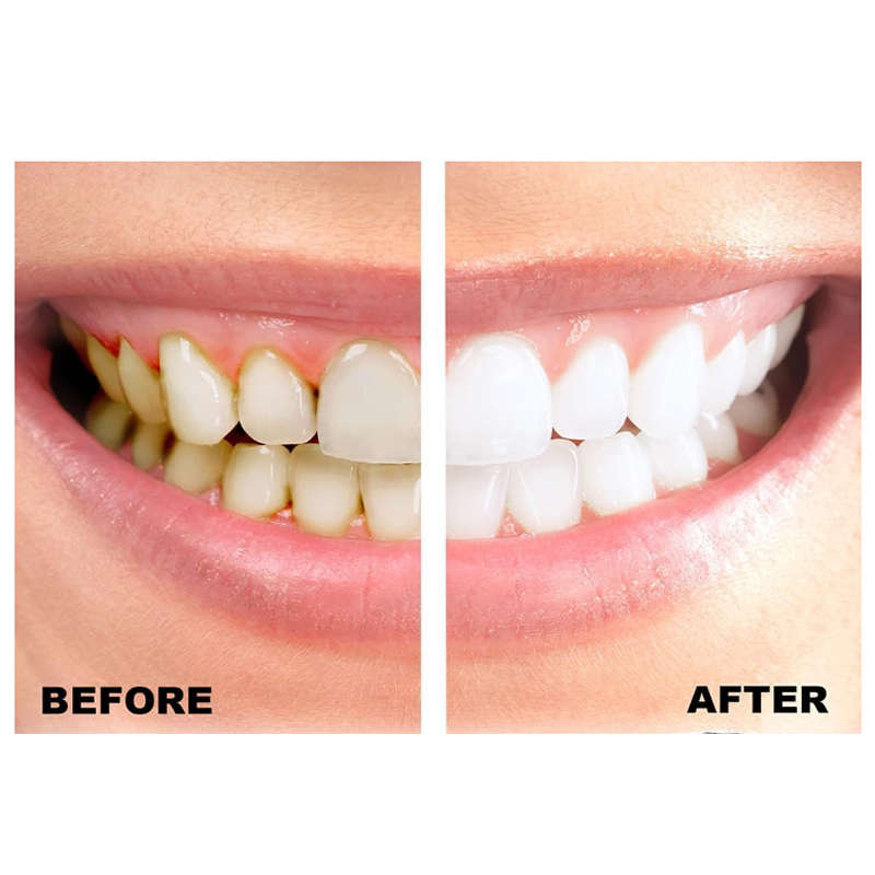 7-Day Fresh Breath Dazzling White Teeth Whitening Powder for Bright Smiles BD-18