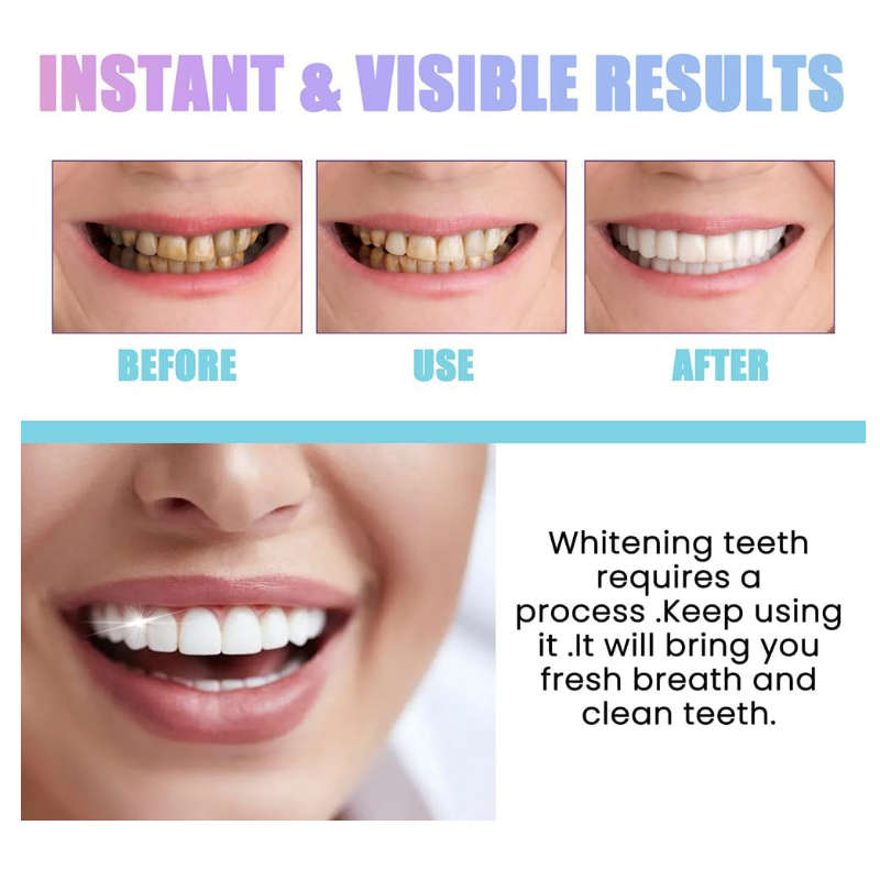 7-Day Fresh Breath Dazzling White Teeth Whitening Powder for Bright Smiles BD-18