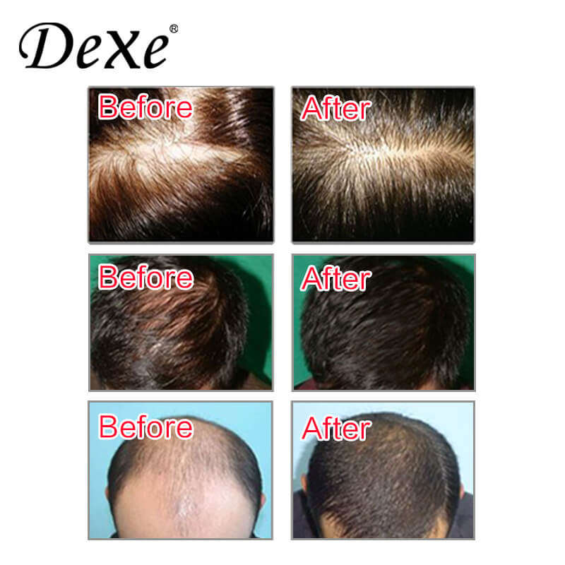 Dexe Hair Building Fibers 22g