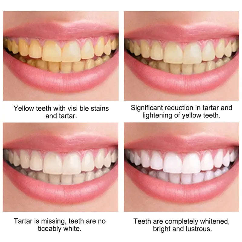 Teeth Whitening Mousse Toothpaste Dental Bleach Cleaning Tools Removes Stains Oral Hygiene Fresh ...