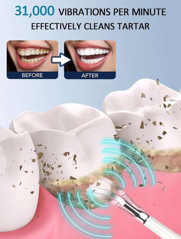 MTech Teeth Cleaner, Teeth Cleaning, Sono Sparkle Dental Cleaner, 31,000 Vibrations Per Minute, L...