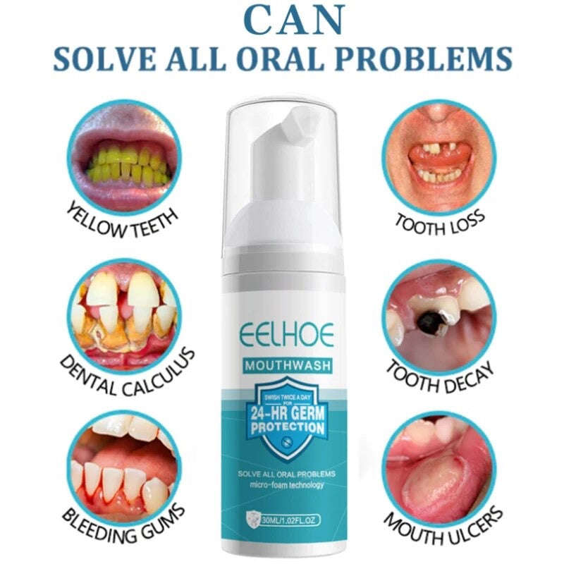 Teeth Whitening Mousse Toothpaste Dental Bleach Cleaning Tools Removes Stains Oral Hygiene Fresh ...