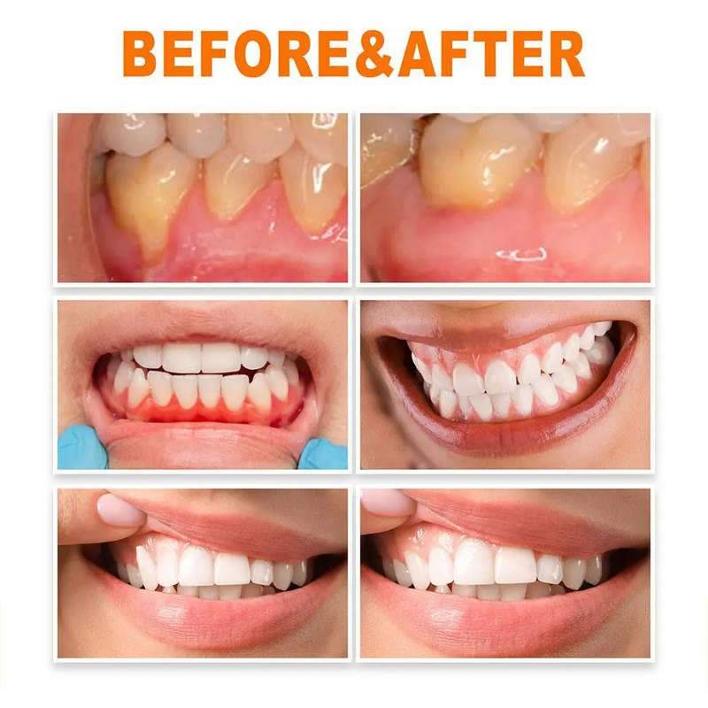 Gum Repair Treatment Ampoules