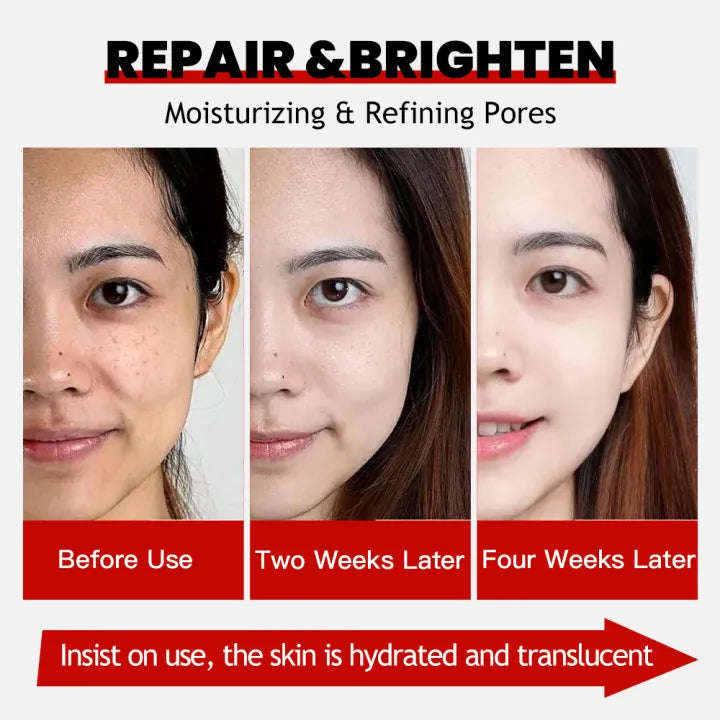 Kojic Acid Essence Toner Repair Brighten Essence Anti Wrinkle Moisturizing Refining Pores Skin Ca...