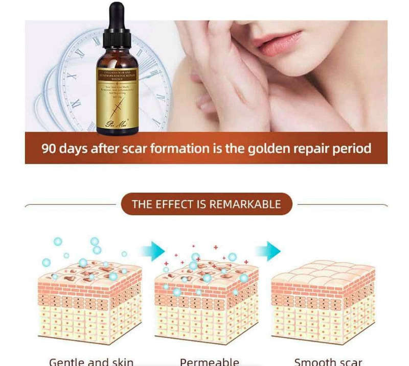 Scar and Acne Mark Removal Repair Essence