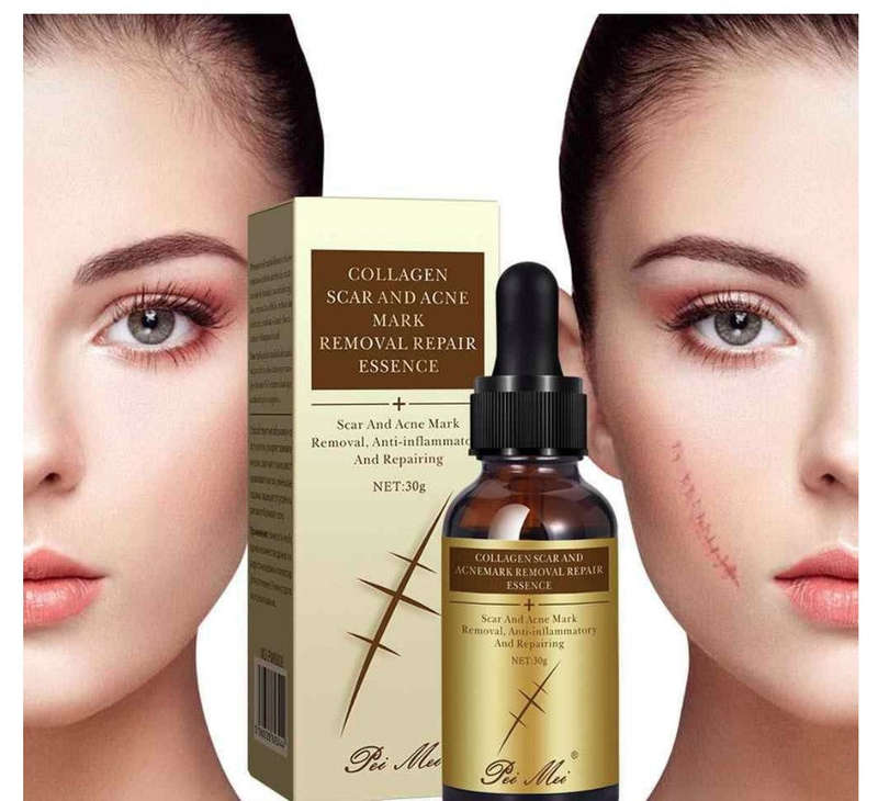 Scar and Acne Mark Removal Repair Essence